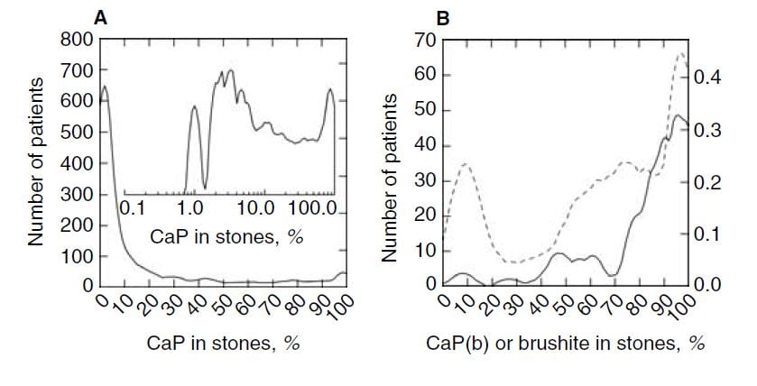 phosphate in stones from our series and KI paper